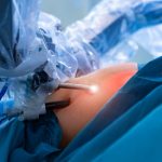 Bariatric Surgery Recovery